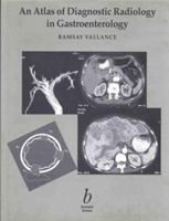 An Atlas of Diagnostic Radiology in Gastroenterology 0632050225 Book Cover