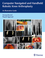 Computer Navigated and Handheld Robotic Knee Arthroplasty: An Illustrative Guide 9390553407 Book Cover