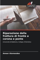 Riparazione della frattura di fronte a corona e ponte: Università di Babilonia, College of Dentistry 6204168053 Book Cover