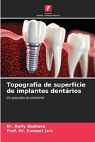 Topografia de superfície de implantes dentários (Portuguese Edition) 6209456596 Book Cover