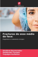 Fracturas do osso médio da face (Portuguese Edition) 6207203410 Book Cover