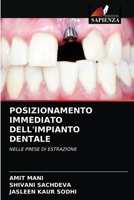 Posizionamento Immediato Dell'impianto Dentale 6203216488 Book Cover