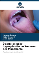 Überblick über hyperplastische Tumoren der Mundhöhle (German Edition) 6200449597 Book Cover