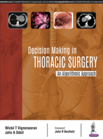 Decision Making in Thoracic Surgery 9352700384 Book Cover