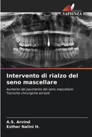 Intervento di rialzo del seno mascellare (Italian Edition) 6208268206 Book Cover