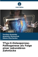 ?Typ-II-Osteoporose-Pathogenese als Folge einer sekundären Zahnlücke (German Edition) 6207693221 Book Cover