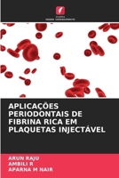 APLICAÇÕES PERIODONTAIS DE FIBRINA RICA EM PLAQUETAS INJECTÁVEL (Portuguese Edition) 6208794137 Book Cover