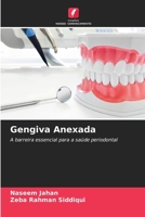 Gengiva Anexada (Portuguese Edition) 6208305462 Book Cover