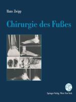 Chirurgie Des Fusses 3709173663 Book Cover