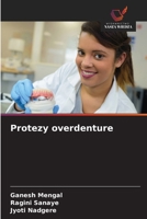 Protezy overdenture (Polish Edition) 6208540410 Book Cover