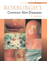 Roxburgh's Common Skin Diseases 0340762322 Book Cover