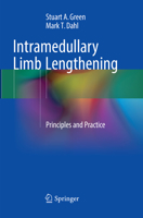 Intramedullary Limb Lengthening: Principles and Practice 3319602969 Book Cover