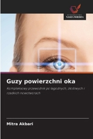 Guzy powierzchni oka (Polish Edition) 6207824415 Book Cover