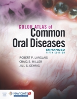Color Atlas of Common Oral Diseases, Enhanced Edition 1284240983 Book Cover