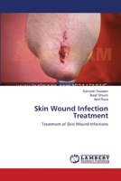 Skin Wound Infection Treatment 3659616680 Book Cover