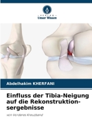 Einfluss der Tibia-Neigung auf die Rekonstruktion-sergebnisse (German Edition) 6209499619 Book Cover