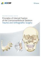 Principles of Internal Fixation of the Craniomaxillofacial Skeleton: Trauma and Orthognathic Surgery 3131714816 Book Cover