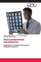 Macroadenomas hipofisarios: Diagnóstico mediante Resonancia Magnética Nuclear. 6202124156 Book Cover