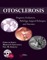 Otosclerosis: Diagnosis, Evaluation, Pathology, Surgical Techniques, and Outcomes 1597565075 Book Cover