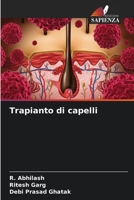 Trapianto di capelli (Italian Edition) 6206994929 Book Cover