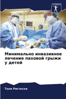 Минимально инвазивное лечение паховой грыжи у детей 6205815230 Book Cover