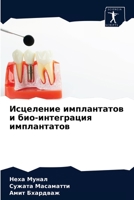 Исцеление имплантатов и био-интеграция имплантатов 620331823X Book Cover