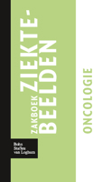 Zakboek Ziektebeelden Oncologie 9031364908 Book Cover
