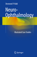 50 Illustrated Cases in Neuro-Ophthalmology 144712409X Book Cover