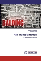 Hair Transplantation: A detailed elucidation 6200538921 Book Cover