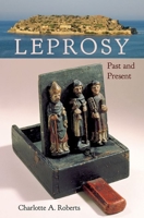 Leprosy : Past and Present 1683401840 Book Cover