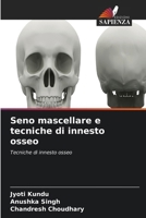 Seno mascellare e tecniche di innesto osseo (Italian Edition) 6630190106 Book Cover