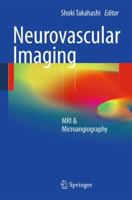 Neurovascular Imaging: MRI & Microangiography 1848821336 Book Cover