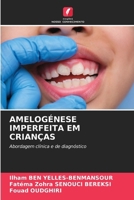 Amelogénese Imperfeita Em Crianças (Portuguese Edition) 6207198816 Book Cover
