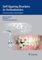 Self-Ligating Brackets in Orthodontics: Current Concepts and Techniques 1584885025 Book Cover