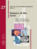 Tumors of the Liver (AFIP Atlas of Tumor Pathology, Series 4,) 1933477415 Book Cover