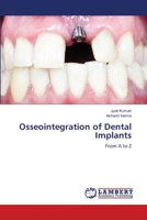 Osseointegration of Dental Implants: From A to Z 6205640732 Book Cover