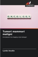 Tumori mammari maligni (Italian Edition) 6207681584 Book Cover