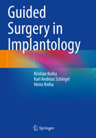 Guided Surgery in Implantology 3030752151 Book Cover