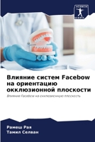Влияние систем Facebow на ориен 6205576813 Book Cover