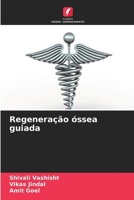 Regeneração óssea guiada 6205619547 Book Cover