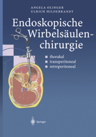 Endoskopische Wirbelsaulenchirurgie: Thorakal . Transperitoneal . Retroperitoneal 3540664777 Book Cover