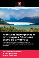 Fracturas incompletas e articulações falsas nos ossos do antebraço: Tratamento cirúrgico complexo de fraturas inconstituídas e falsas articulações dos ossos do antebraço 6203070319 Book Cover