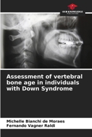 Assessment of vertebral bone age in individuals with Down Syndrome 620763117X Book Cover