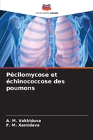 Pécilomycose et échinococcose des poumons 6206356302 Book Cover