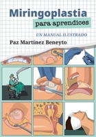 Miringoplastia para aprendices: Un manual ilustrado 8409081830 Book Cover