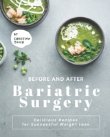 Before and After Bariatric Surgery: Delicious Recipes for Successful Weight Loss B091F5SNKZ Book Cover