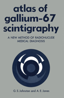 Atlas of Gallium-67 Scintigraphy: A New Method of Radionuclide Medical Diagnosis 1461344980 Book Cover