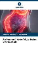 Fallen und Artefakte beim Ultraschall (German Edition) 6207010795 Book Cover
