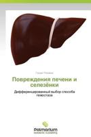 Povrezhdeniya Pecheni I Selezyenki 3659988650 Book Cover