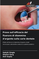 Prove sull'efficacia del fluoruro di diammina d'argento sulla carie dentale (Italian Edition) 6208153743 Book Cover